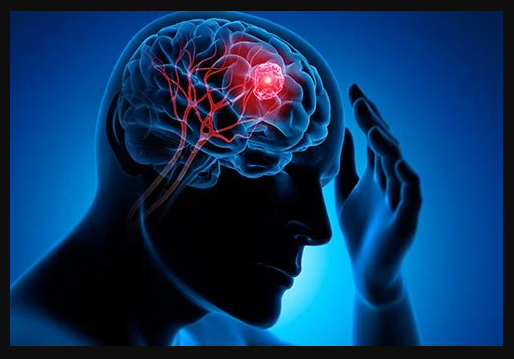 Brain Surgery or Neurosurgery   