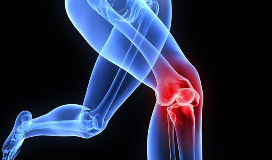 Arthroscopic Surgery   